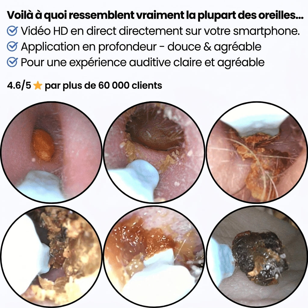 Morpheto - Clear Ear™