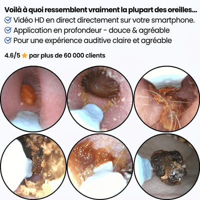 Morpheto - Clear Ear™