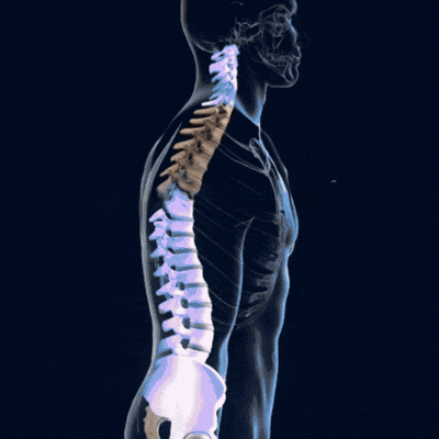 Morpheto - CorrectFlex™