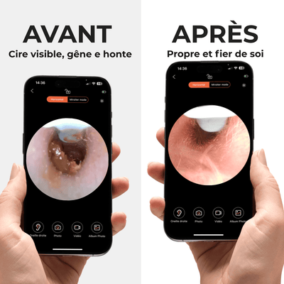 Morpheto - Clear Ear™